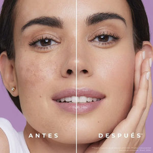 CREMA ACLARANTE CORPORAL | ACLARA, HIDRATA Y RENUEVA💫 PAGO CONTRA ENTREGA 🚚 + ENVÍO GRATIS ✈️