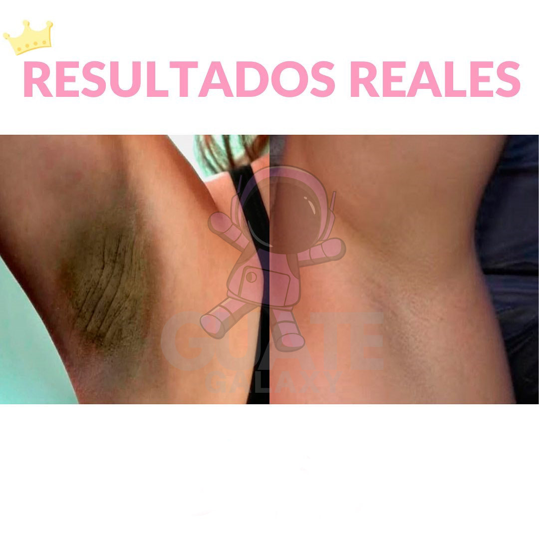 CREMA ACLARANTE CORPORAL | ACLARA, HIDRATA Y RENUEVA💫 PAGO CONTRA ENTREGA 🚚 + ENVÍO GRATIS ✈️