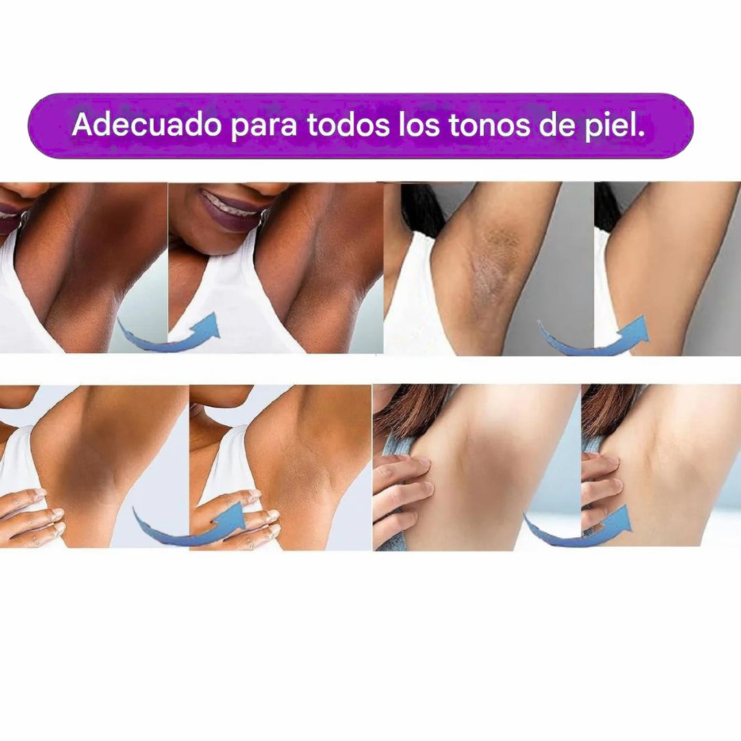CREMA ACLARANTE CORPORAL | ACLARA, HIDRATA Y RENUEVA💫 PAGO CONTRA ENTREGA 🚚 + ENVÍO GRATIS ✈️