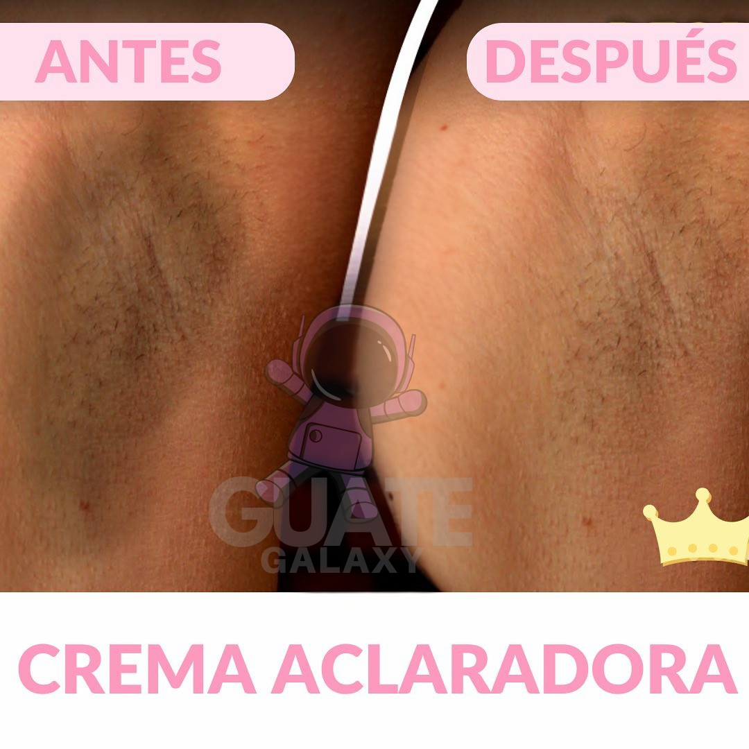 CREMA ACLARANTE CORPORAL | ACLARA, HIDRATA Y RENUEVA💫 PAGO CONTRA ENTREGA 🚚 + ENVÍO GRATIS ✈️